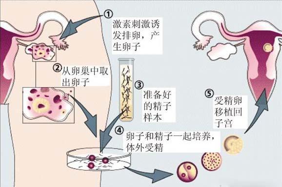 供卵机构是真的吗-供卵机构是真的吗？揭秘供卵机构的真相
