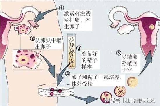 供卵是什么_供卵是什么?解读供卵的概念与过程