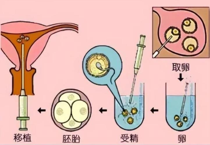 供卵成功率高吗-供卵成功率高吗?一探试管婴儿背后的秘密